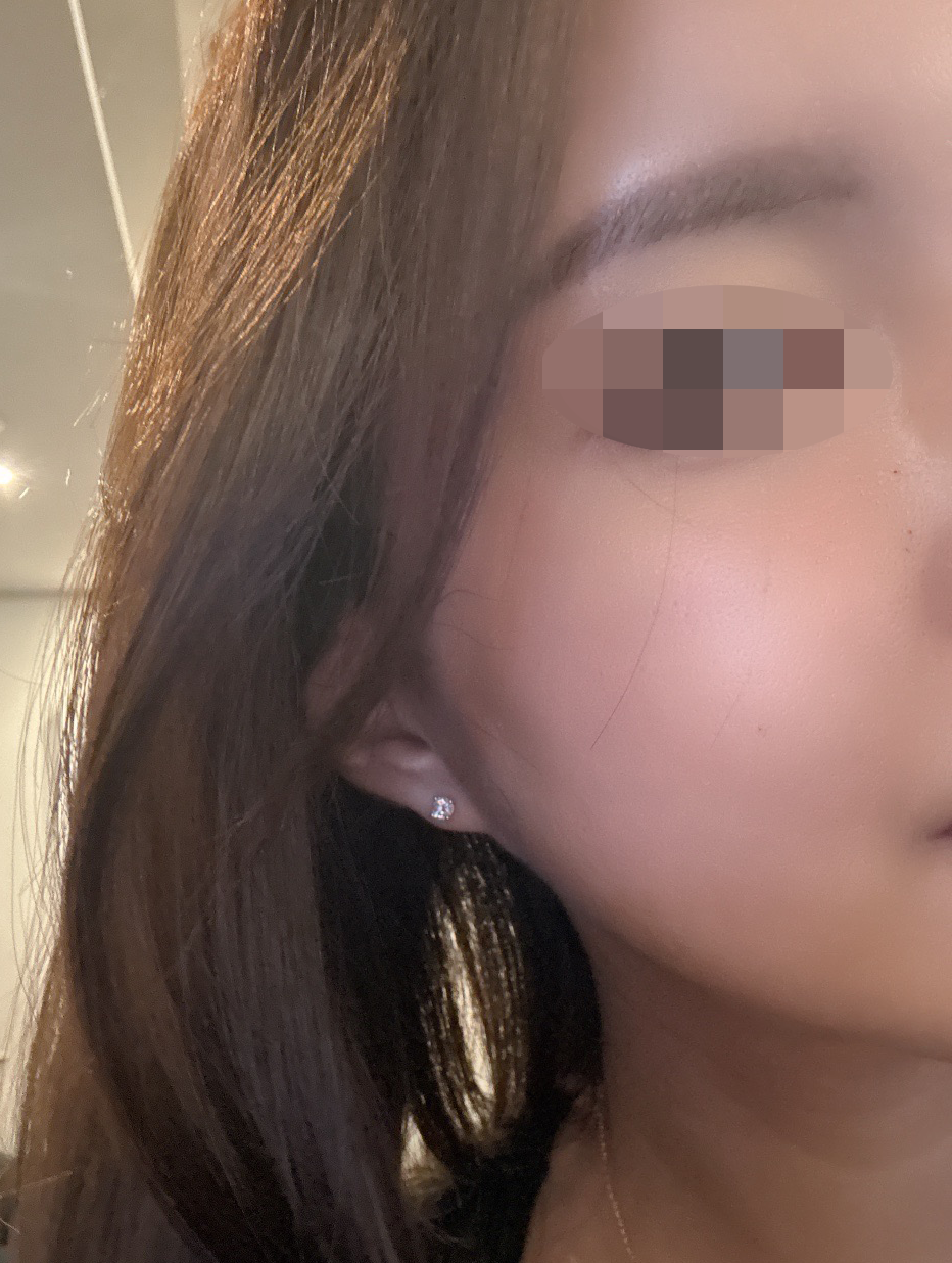 쥬베룩 받았는데 수면이라 편하고 효과 최고예요 ㅎㅎ