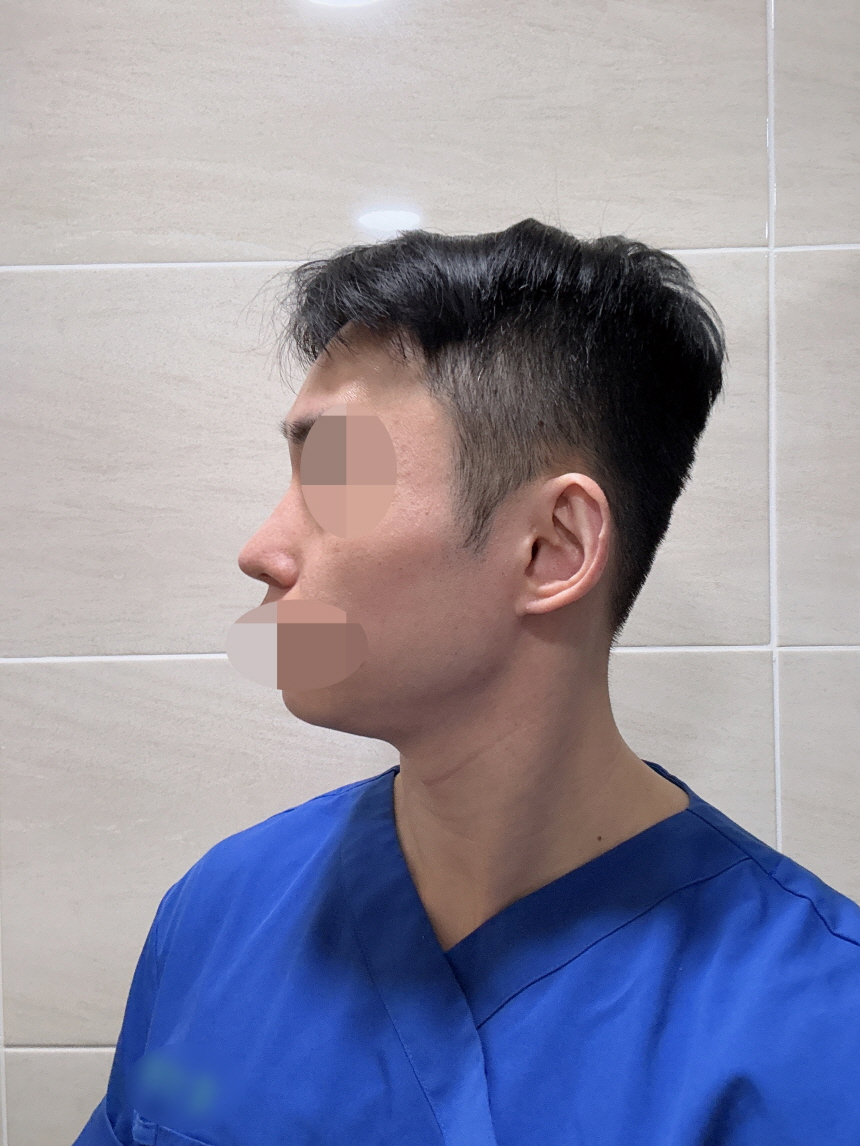 코도 멋있어져서 너무 만족스럽습니다