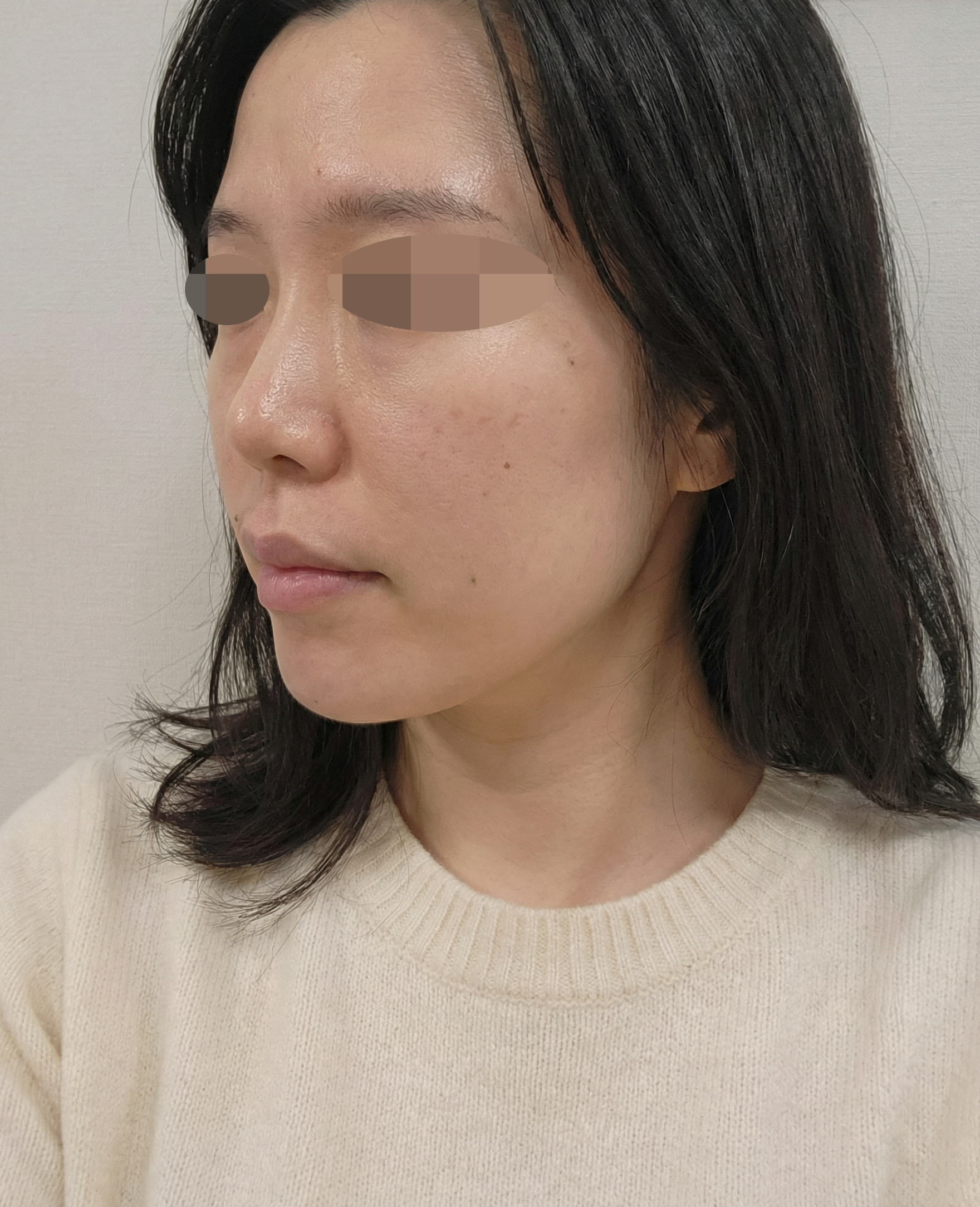 건조+홍조 때문에 처음 받아봤는데 엠보 촘촘해서 기대돼요ㅎㅎ