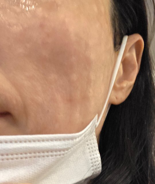 상담하다가 리쥬쎄라로 바로 결정해버렸어요~!