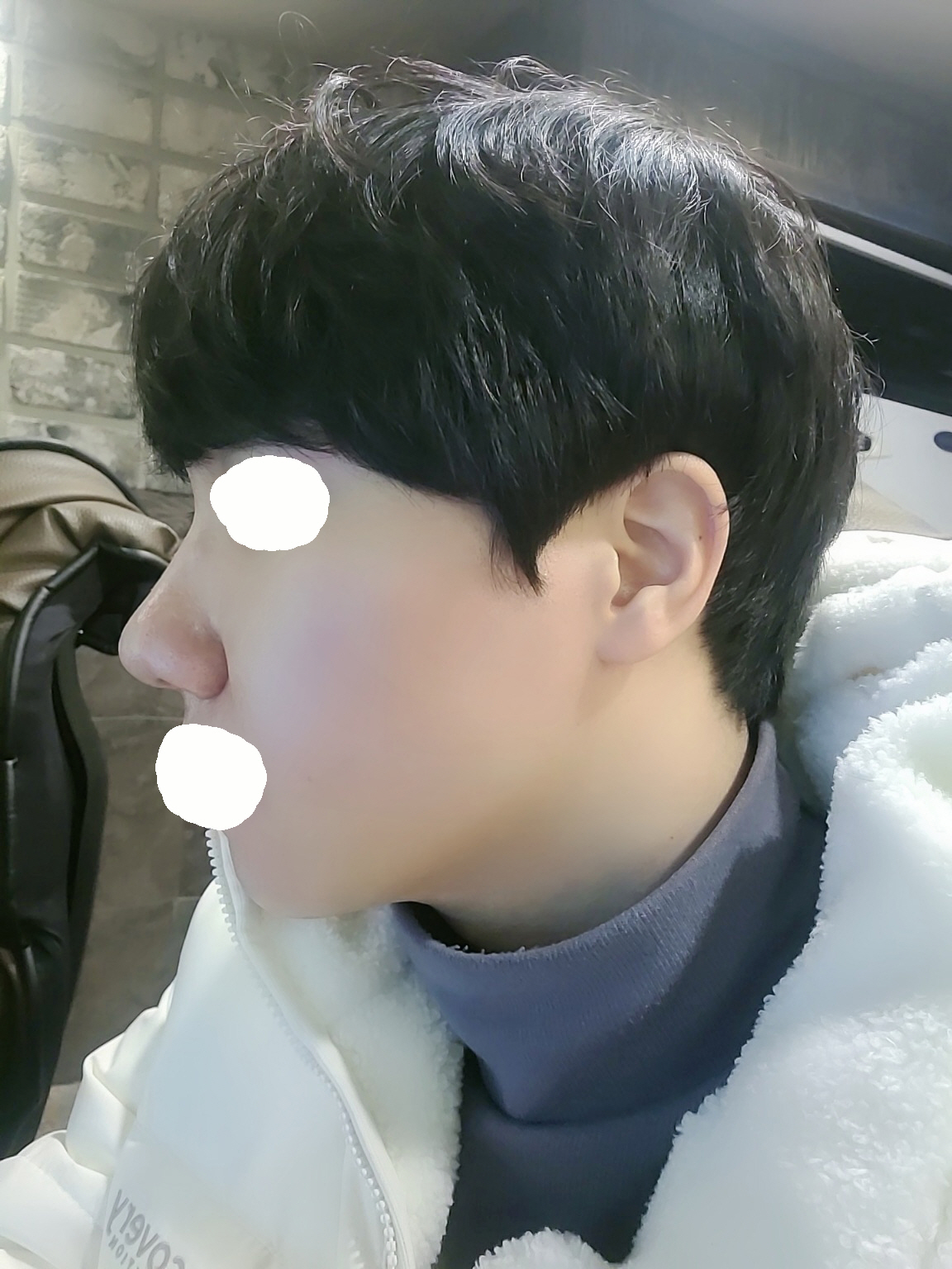 서울아이성형외과를 택해서 너무 다행이다라고 생각하고 있어요.