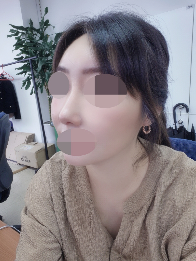 자연스럽게 코끝 오똑해지기 성공이예요