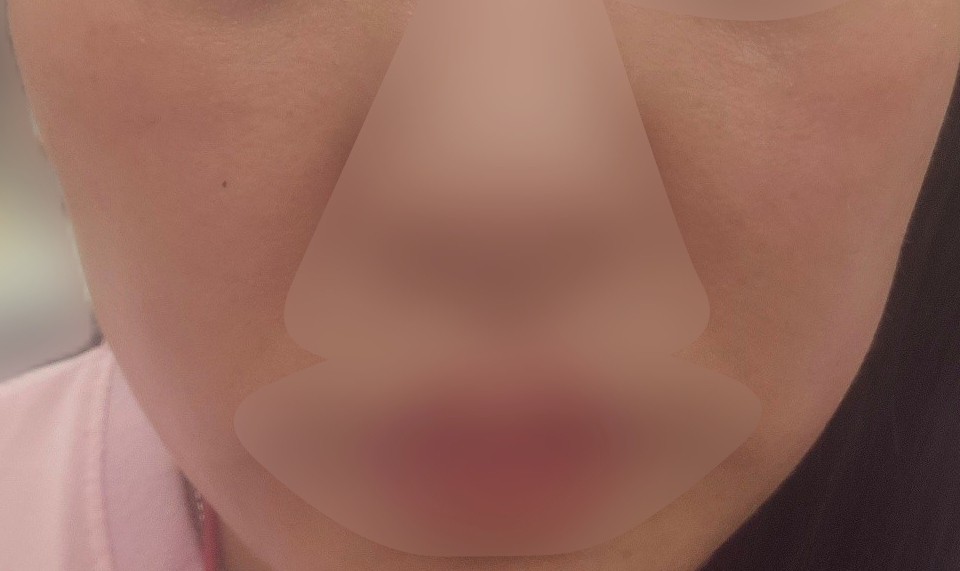 일주일 만에 건조함 사라지고 보들 탱탱한 피부가 됐어요!