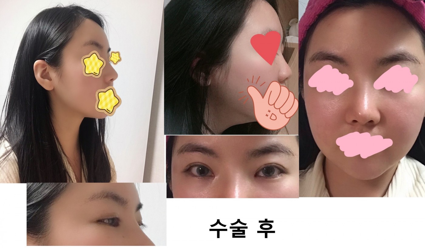 눈코지 2주차 사진입니다 ><