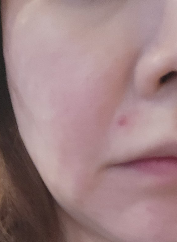 가격도 동일하고 응대도 부담 없어서 편하게 받고 왔어요!!