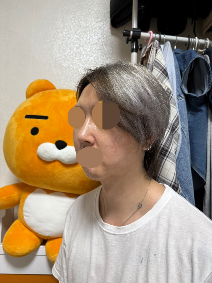 다들 칭찬해줘서 결과도 만족스럽고 부작용또한 없었어요