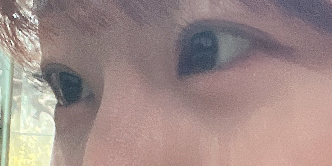 주변에서도 쌍커풀 잘 됐다는 소리 들어서 기분좋아요!!