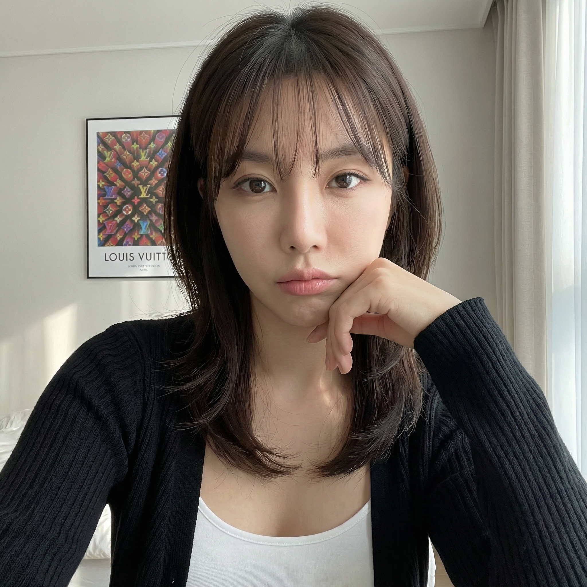서울아이에서 실리프팅+팔자필러 한달차! (윤곽수술 안 함 주의 ㅋㅋㅋ)