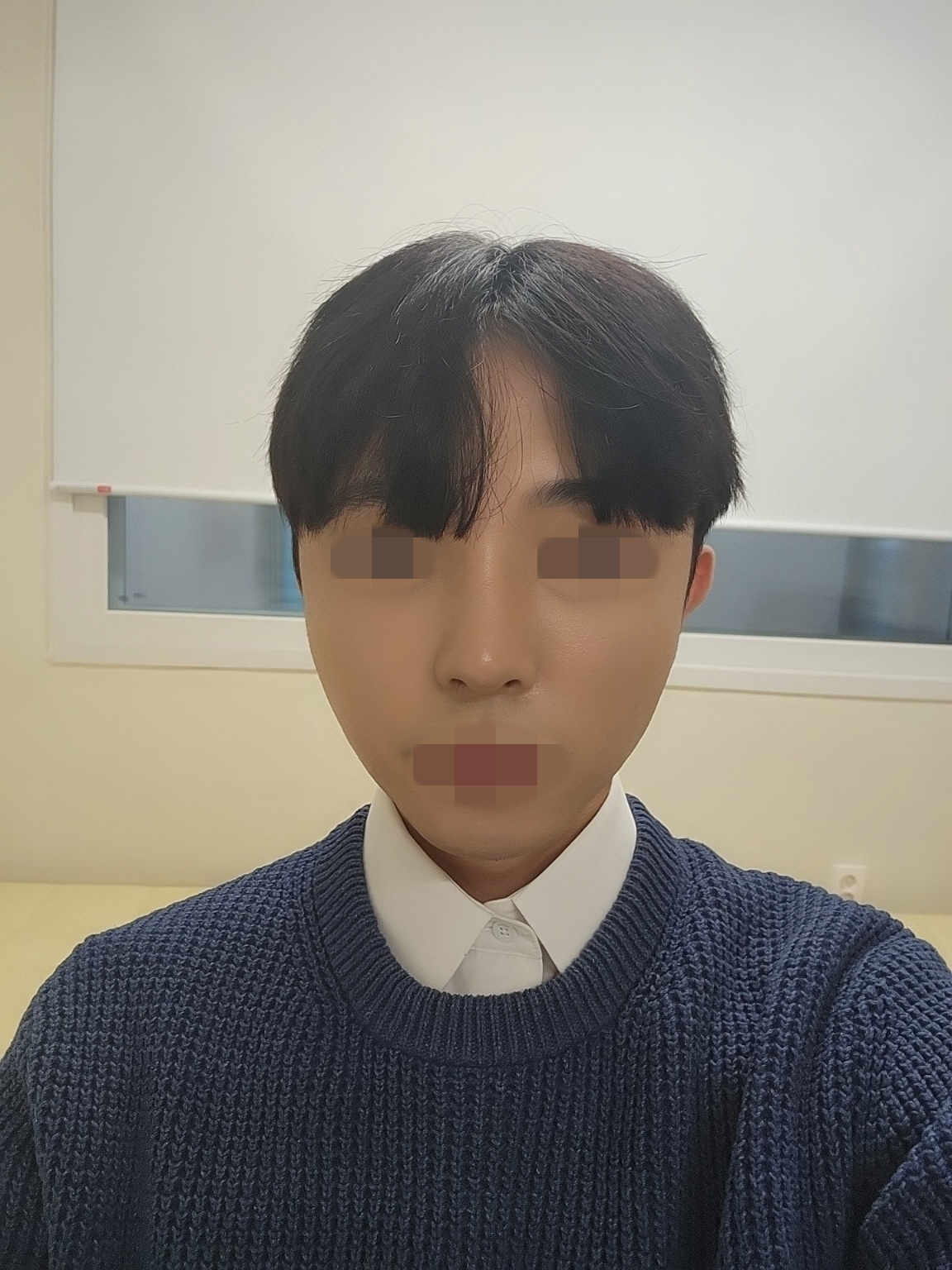 완전 자연스럽고 이쁘게 잘 되어서 만족하고 있습니다.