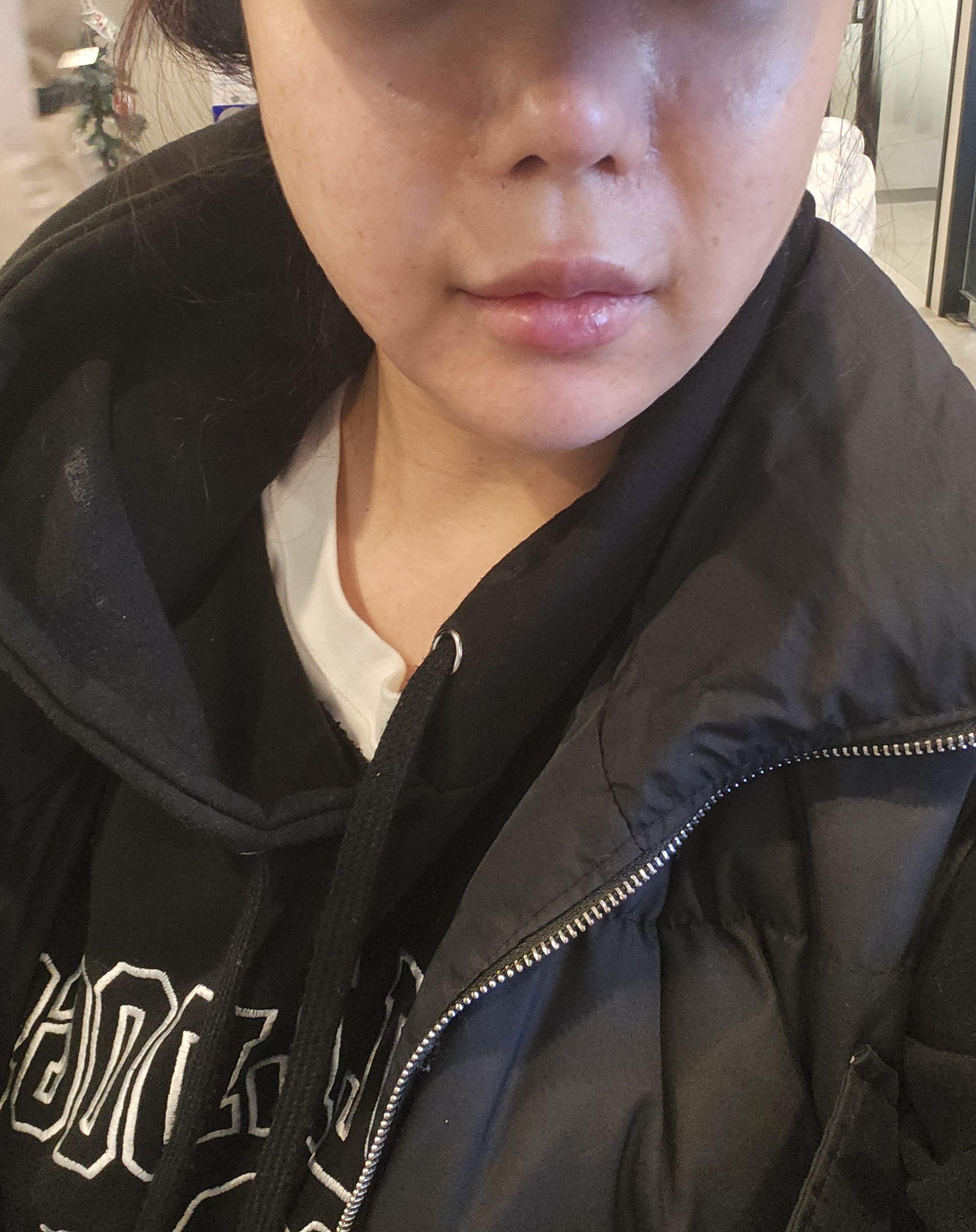 첫 방문 효과 대박이라 재방문! 모공 순삭 조합