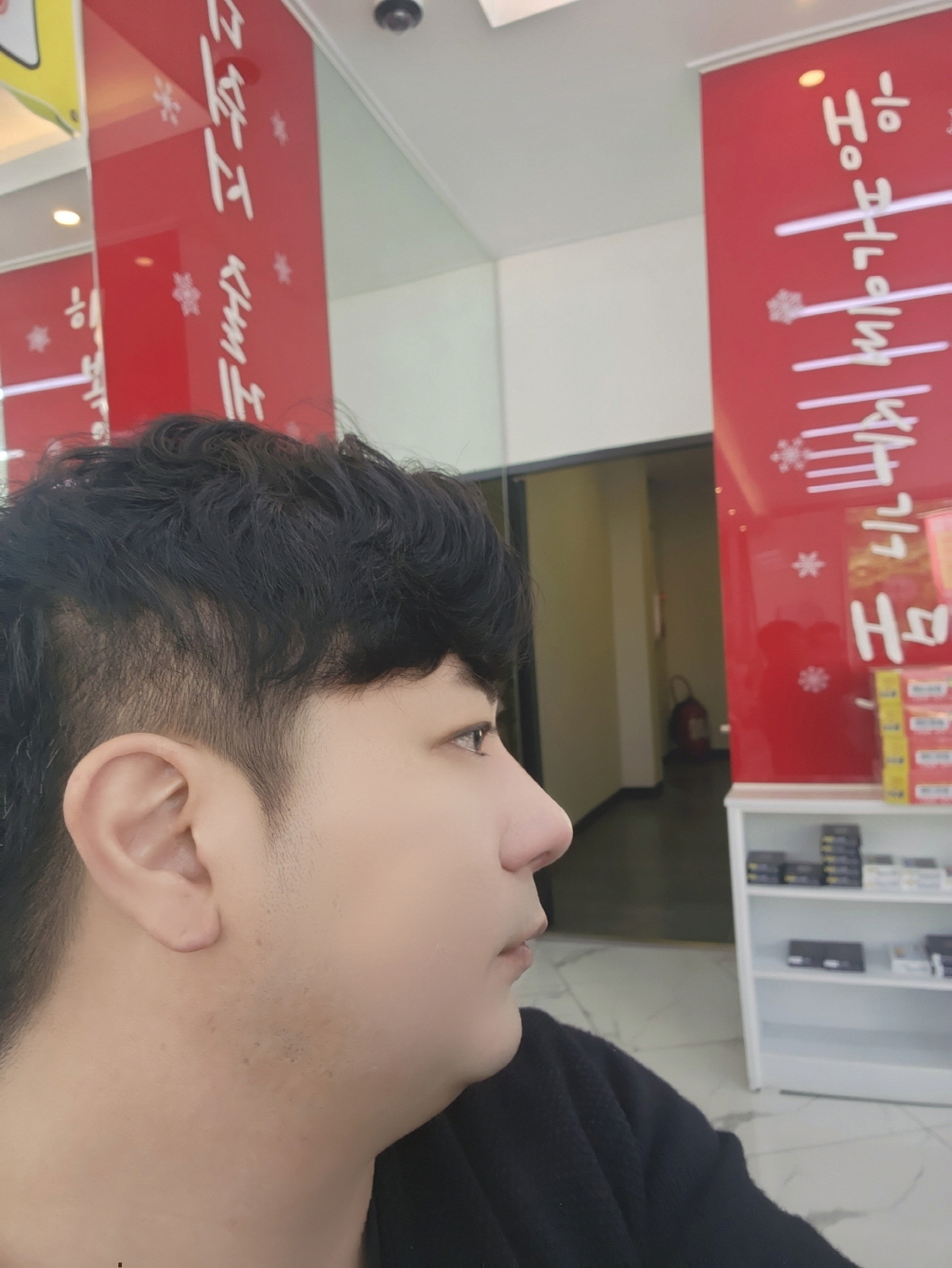 점점 붓기도 빠지고 좋아지면서 자리 잘잡고있는것같아요