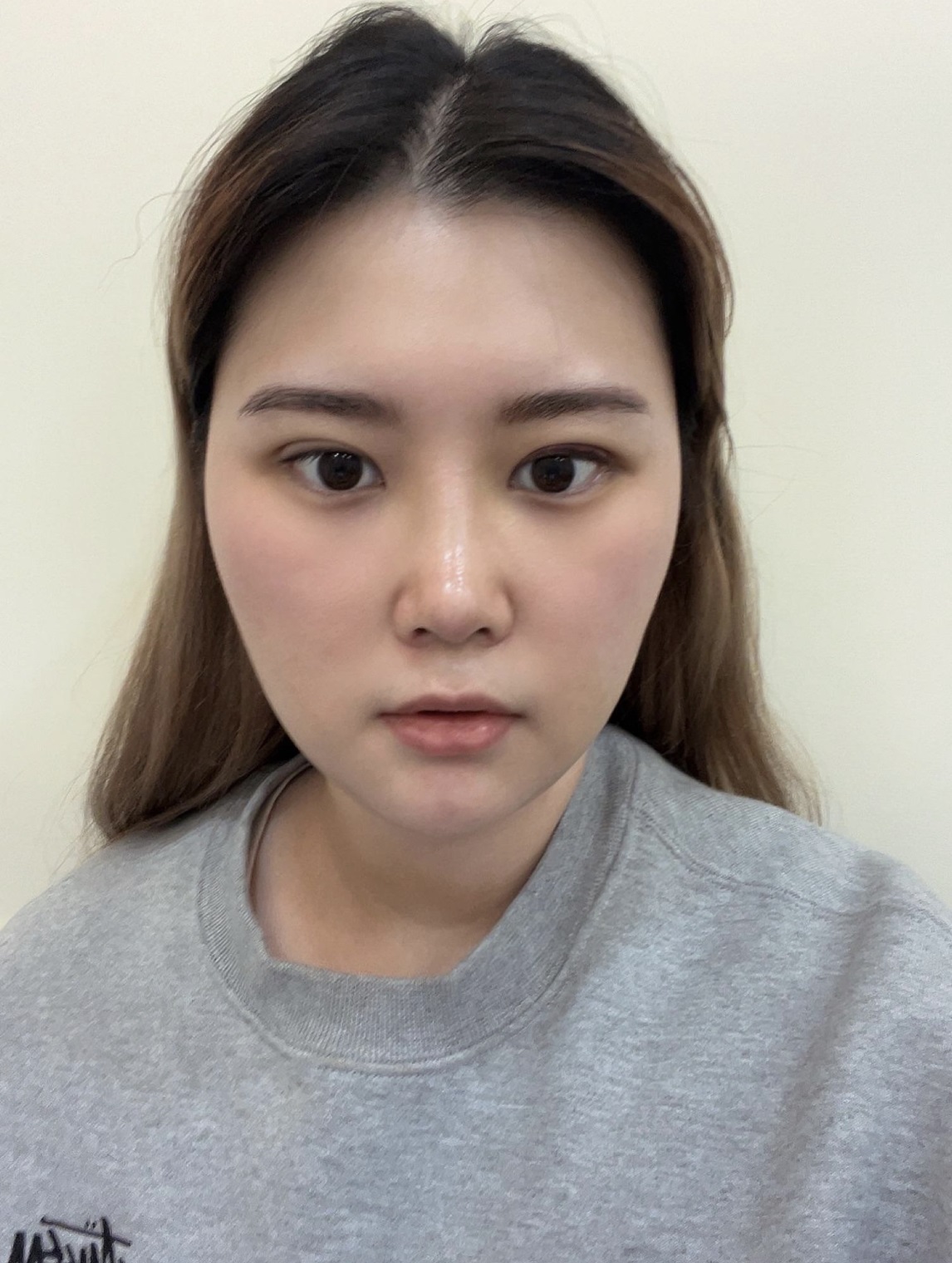 되게 꼼꼼하게 봐주시는 편이라 좋았어요