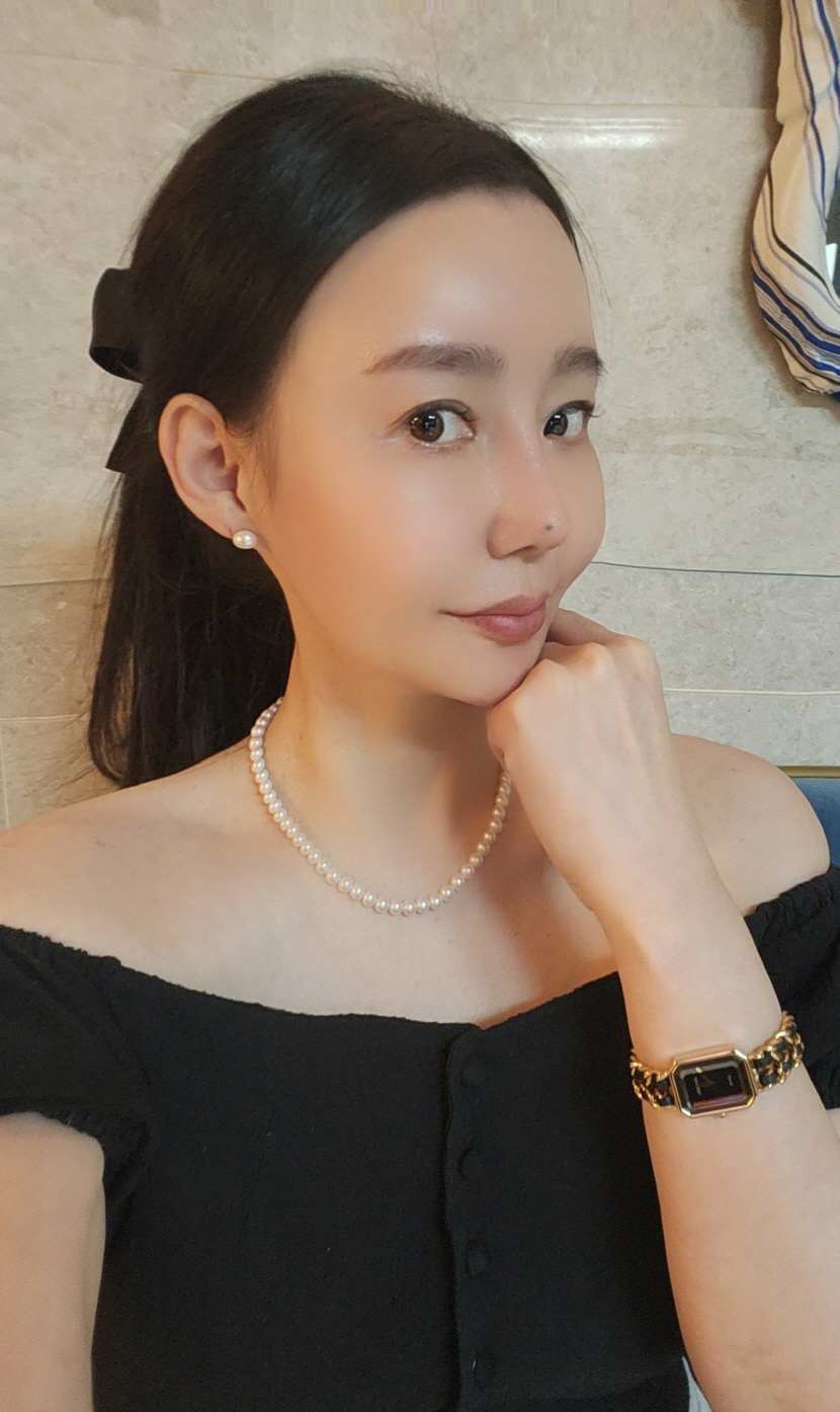 이제재수술하지않아도될거같아요 너무너무너~~~무맘에듭니당~