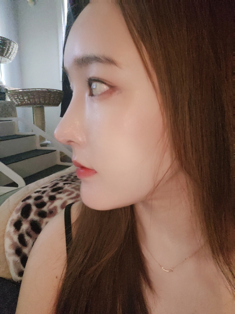코 같이 하길 잘한거같아요 ㅎㅎㅎ 모양도 기능도 해결됫어요 ㅎ