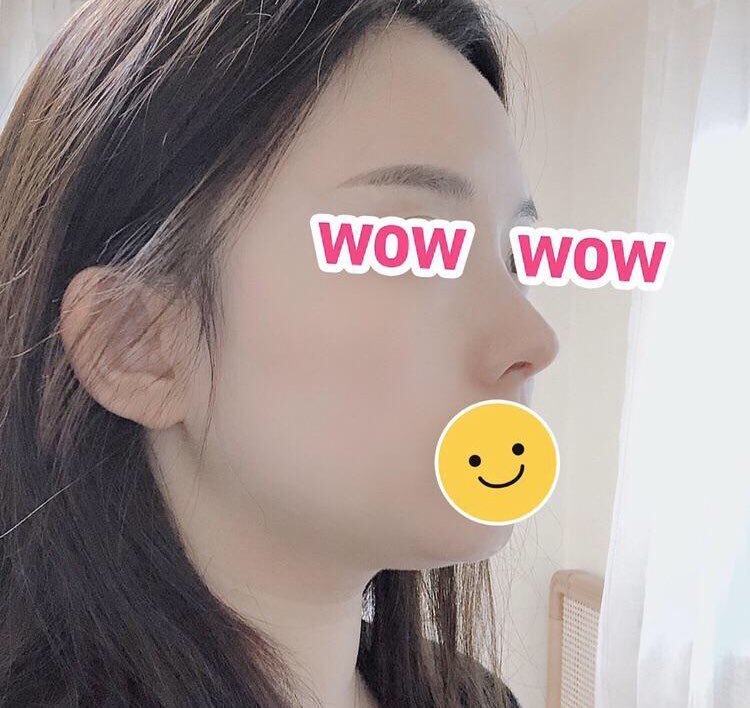 화살코 수수우우울