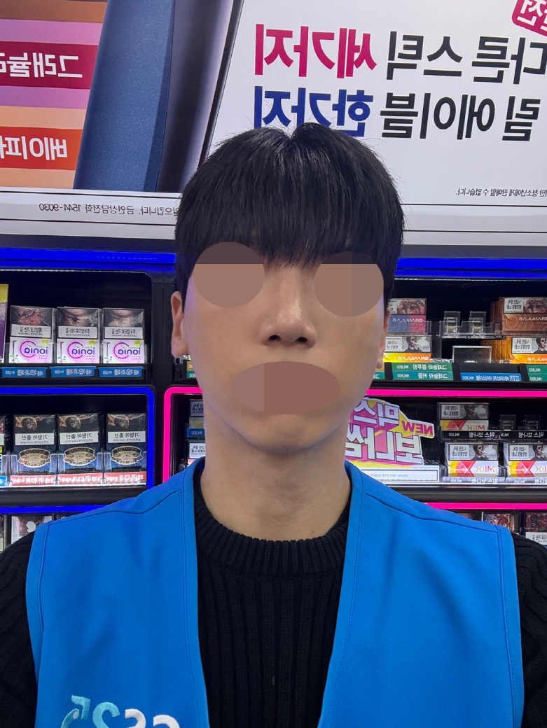 이제 이물감도 거의 안들고 수술하길 너무 잘한선택인거 같아요!!