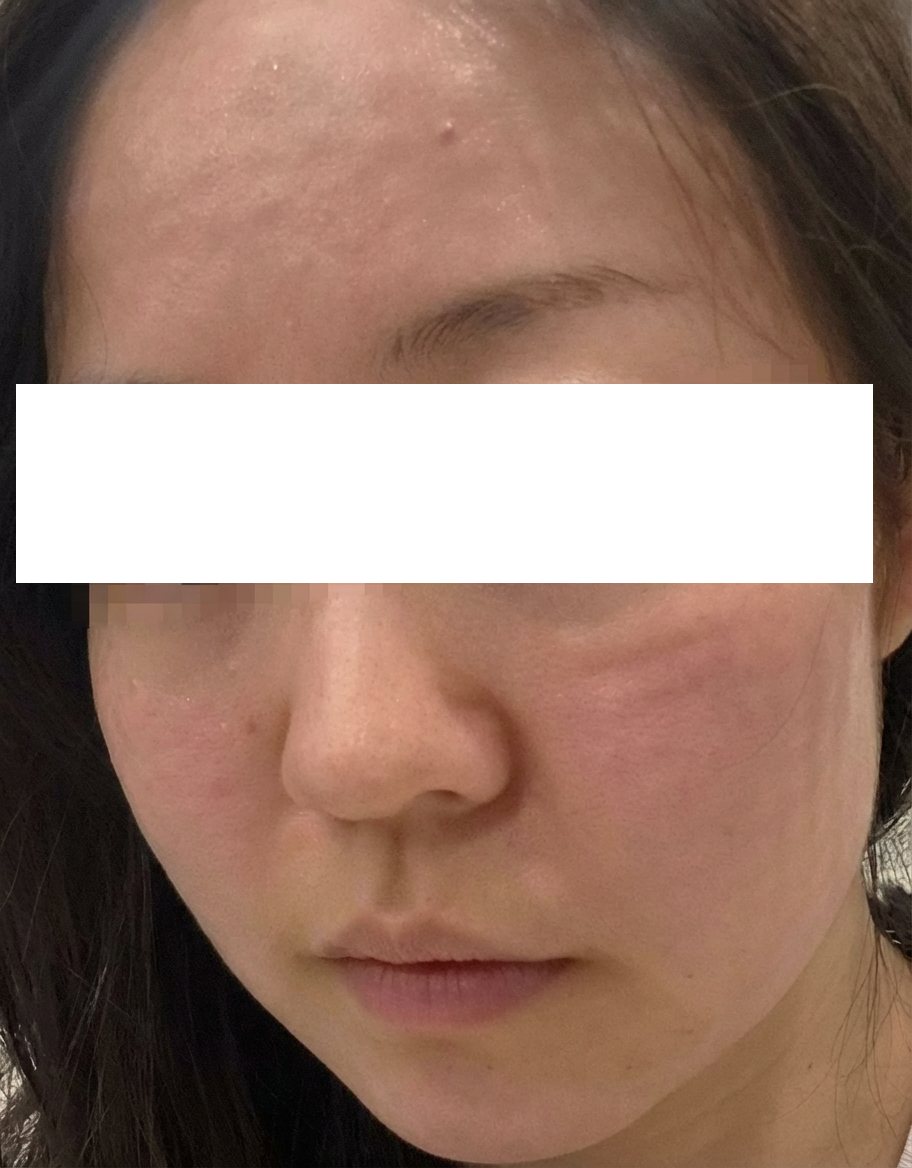 속건조 고민으로 왔는데 강요 없이 편하게 받았어요~ 웨딩 전 관리로 또 오려고요ㅎㅎ