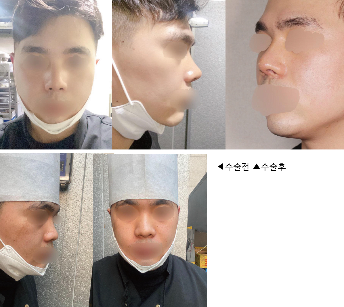 코끝 후기 남겨요