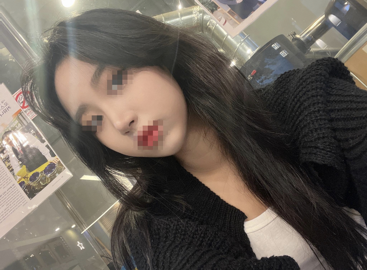 원장님이 자연스럽게 잘 해주신다는 후기들을 보고 방문했어요!!