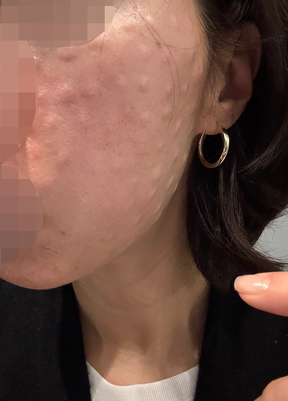 다른 병원이랑 다르게 추가 권유 없어서 좋았어요 ~!