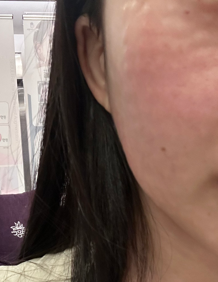 건조함이랑 리프팅 고민으로 슈링크+리쥬란 한번에 챙겼어요!!