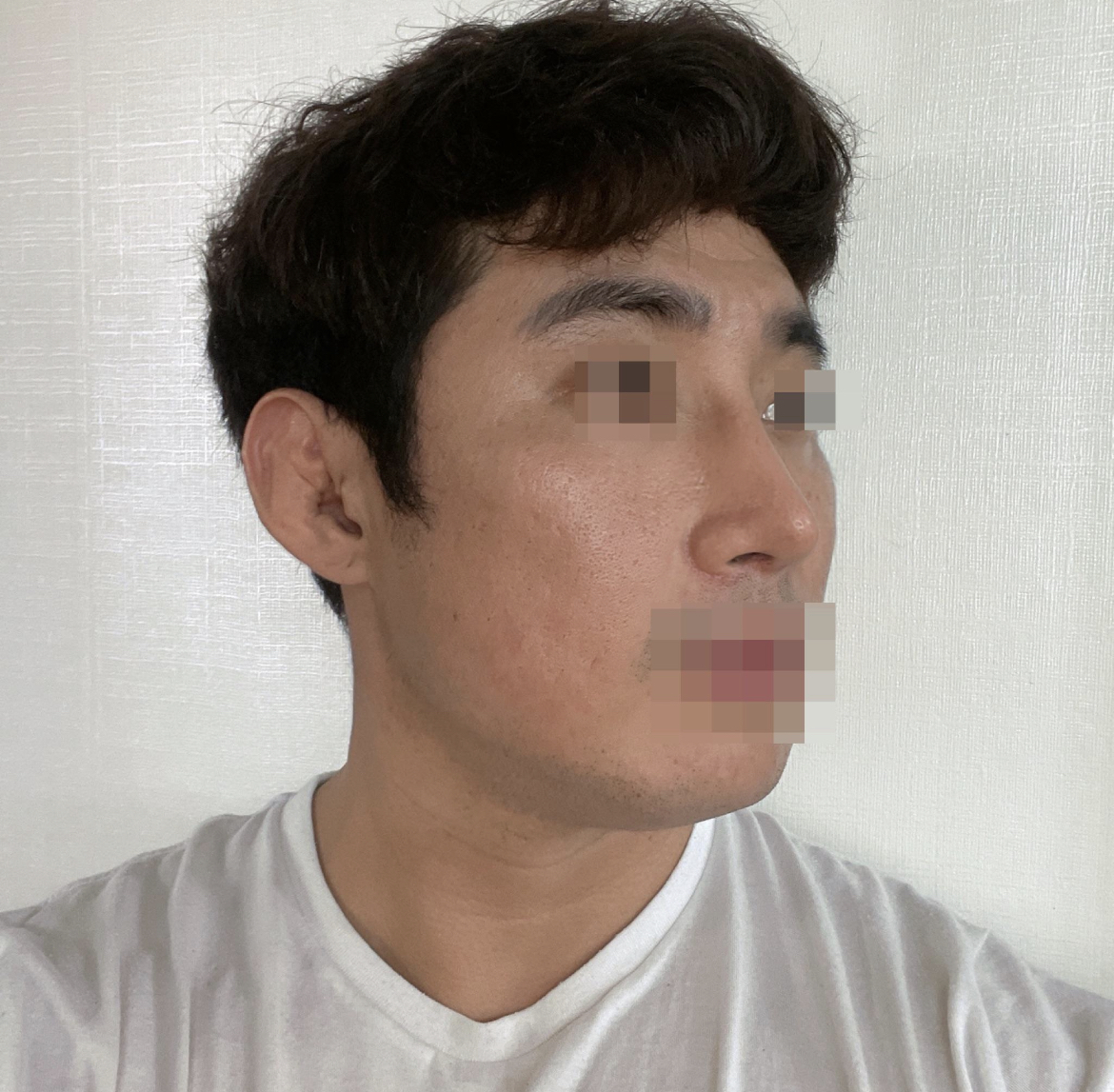코 수술 추천하는 병원입니다.