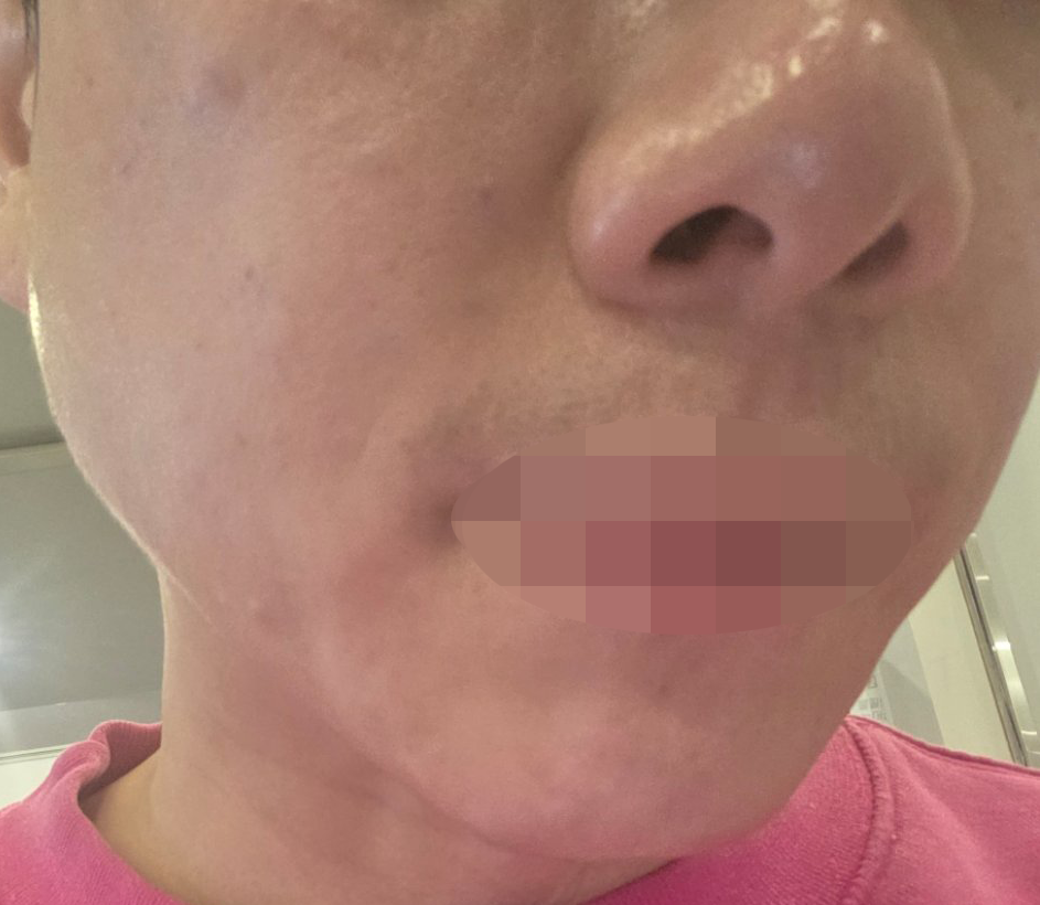 가격도 합리적이고 응대까지 친절해서 마음 편히 받고 왔습니다.
