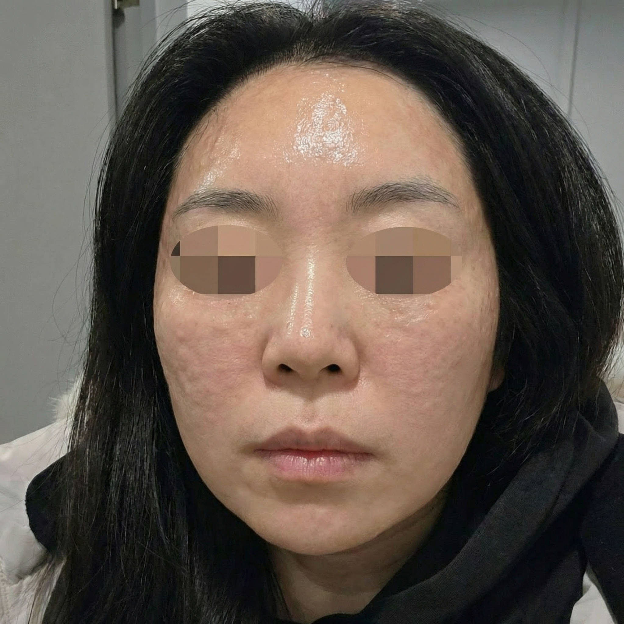 리쥬란 잘하는 곳 찾다가 왔는데 추가 강요 없어서 좋았어요~