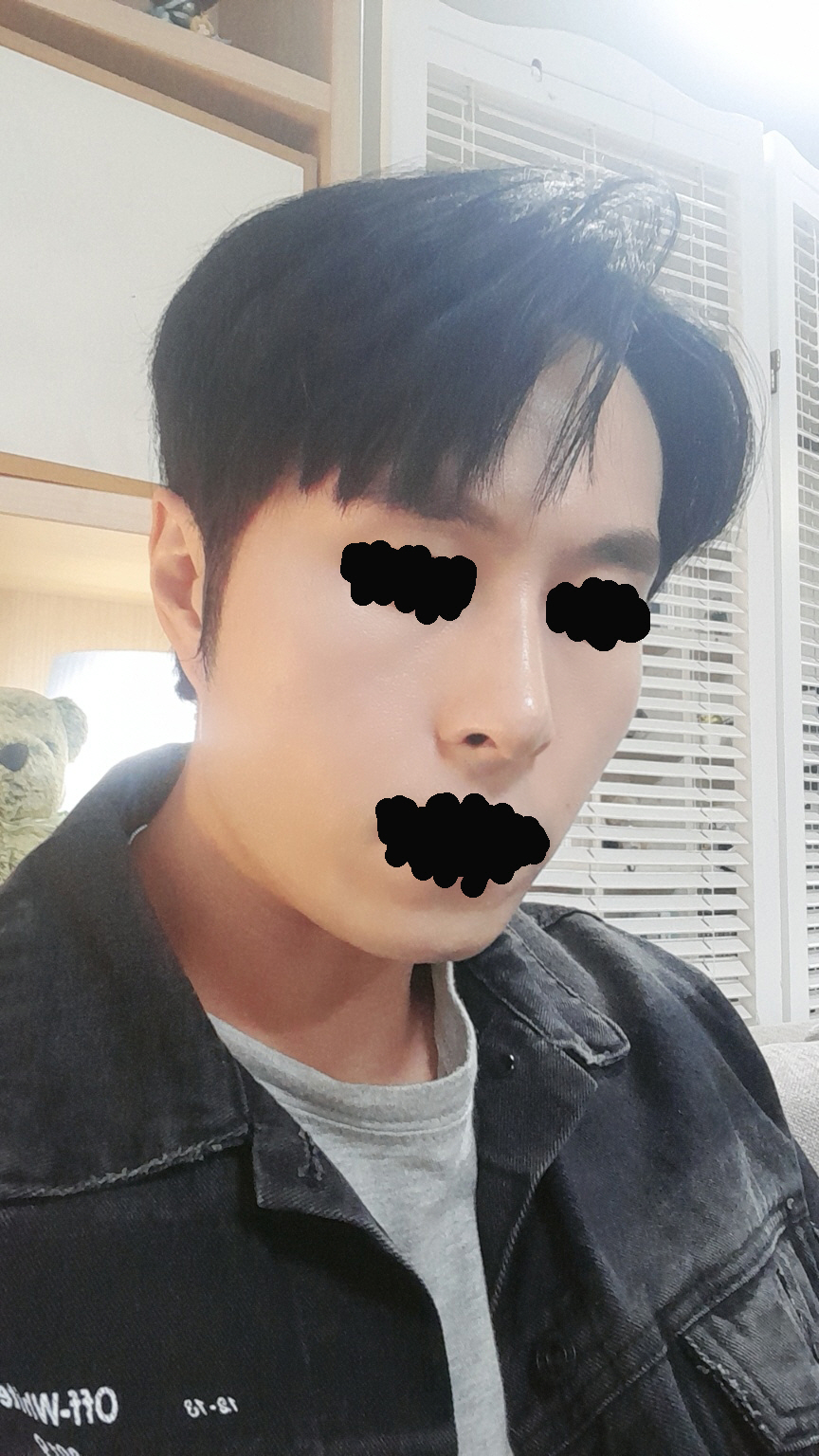 이제 수술한지 한달차 되었는데 지금와서 드는 생각은 왜 이제서야 했을까 입니다