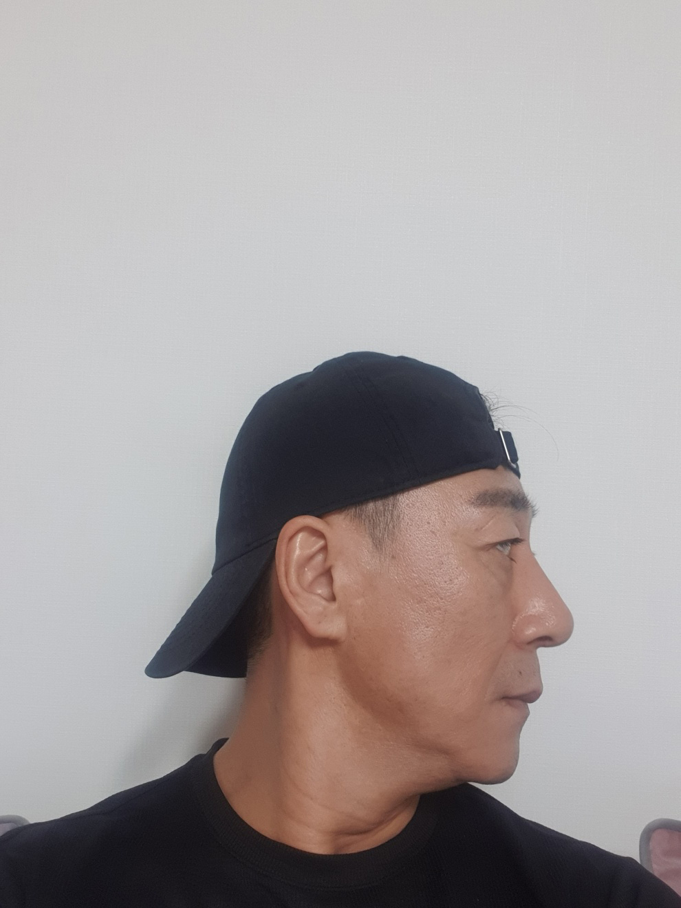 용기내서 한 수술이 잘된거같아 만족해요~