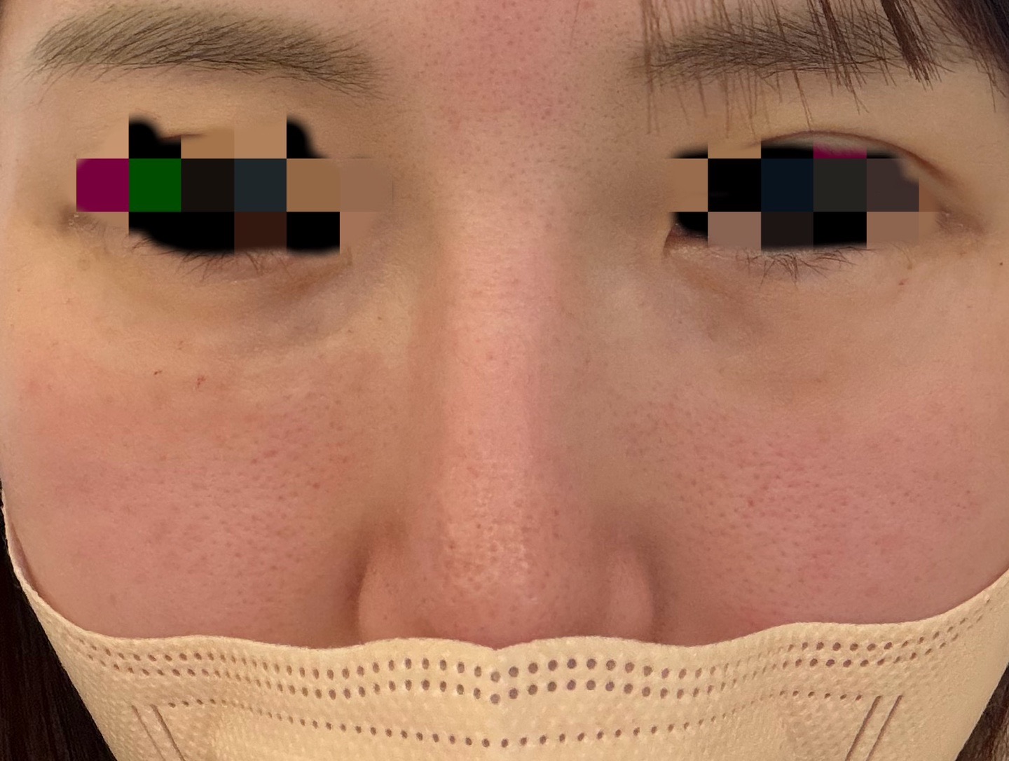 일본어 가능하시고 대기 시간도 짧고 시설 깨끗해서 만족인 것 같아요! 추가 권유 없어서 안심됐어요~!