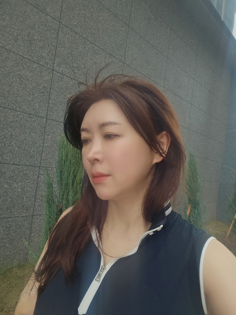 붓기 빠지고 라인이 정리되고 있는데 내 얼굴 처럼 자연스럽게 이뻐져서 만족해요