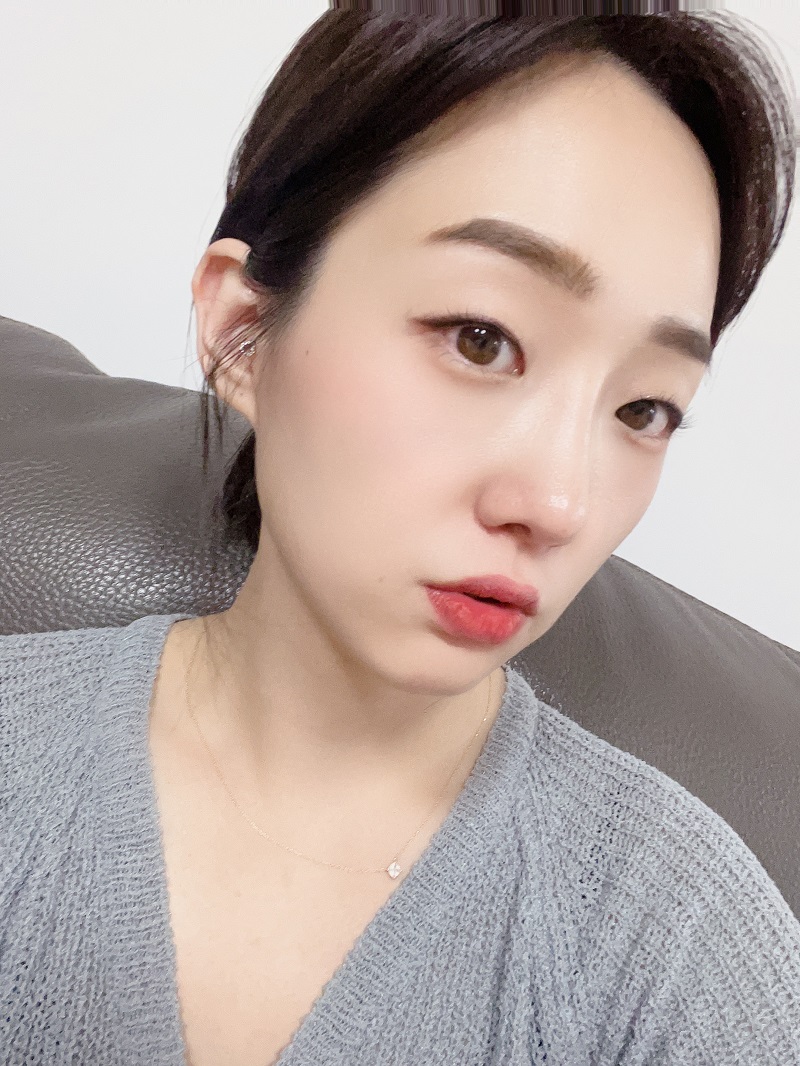 수술하고 한달 됐는데 이제는 원래 내코처럼 스스로도 얼굴에 적응 됐어요!