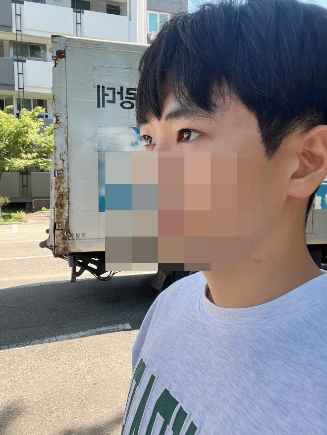 스트레스 받던 눈 극복한 것 같아요