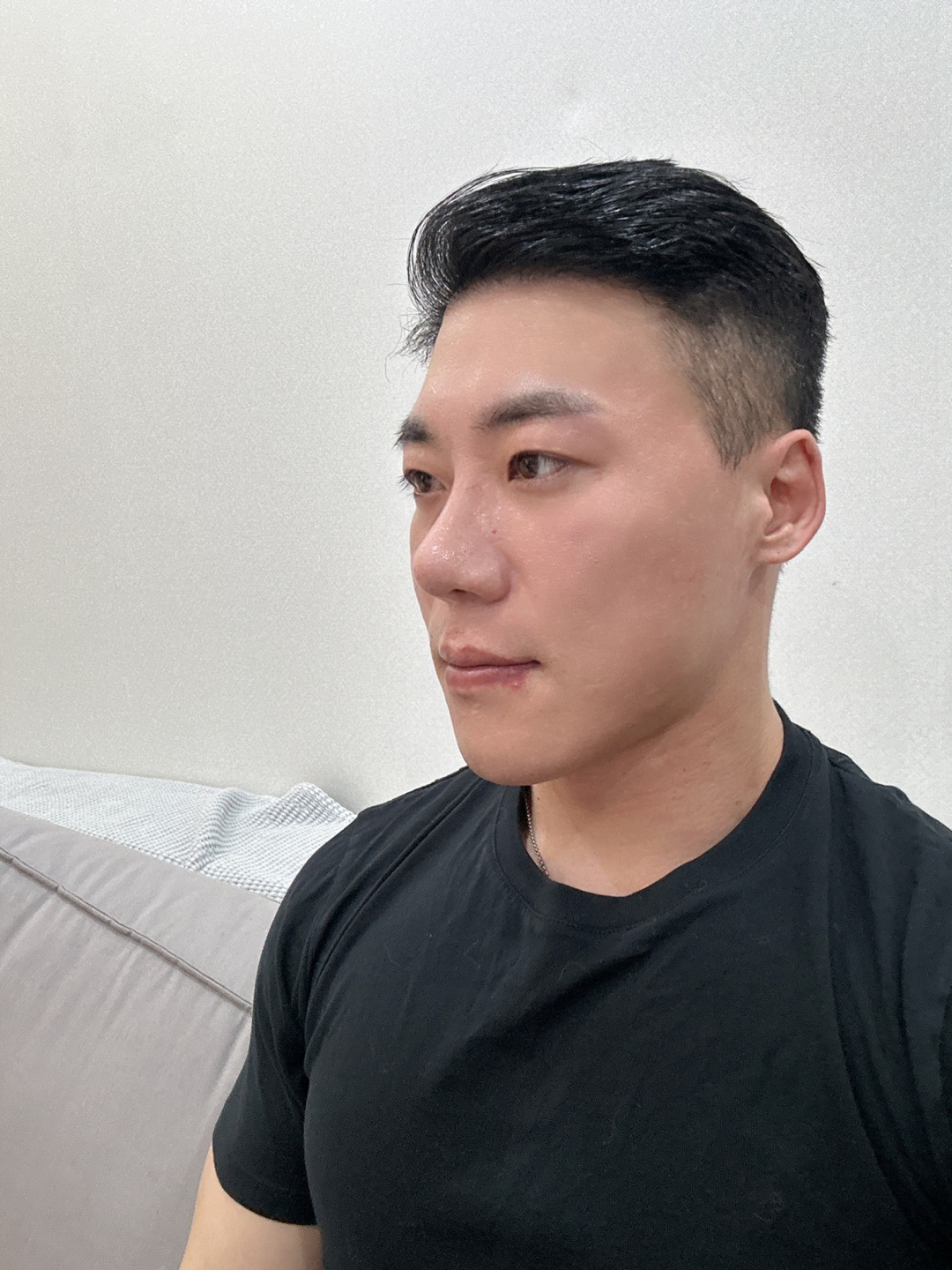 첫코수술인데 정말 믿고 맏긴 보람이 있습니다
