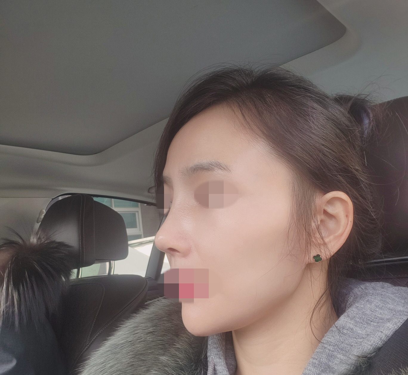 코볼때마다 진작에 할걸 시간만끌었네 후회돼요