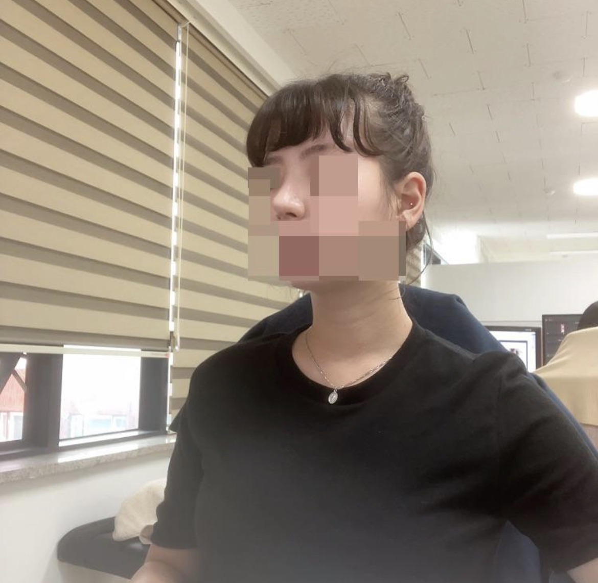하나도 아프지 않았어요 !!