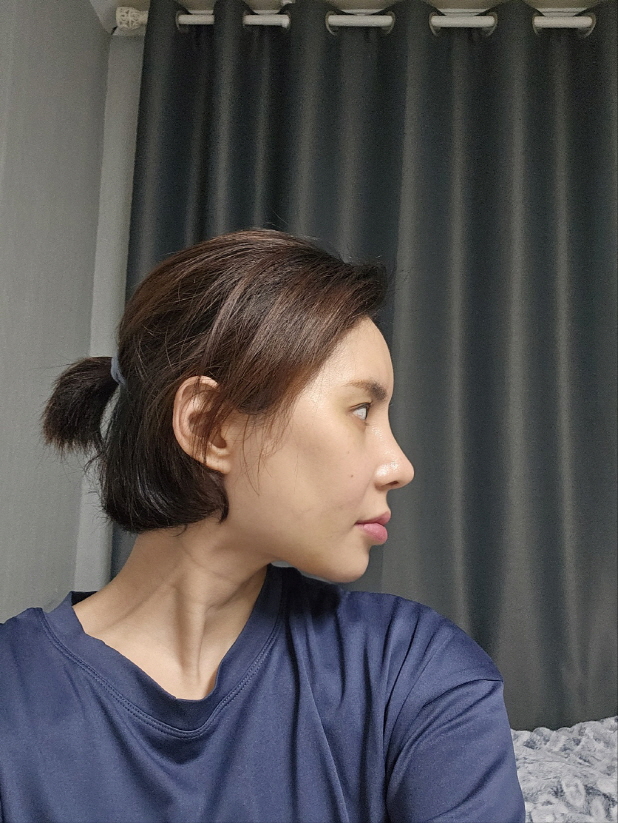 앞으로 더붓기가빠지면 더이뻐지겠죠~~앞으로가 기대됩니다