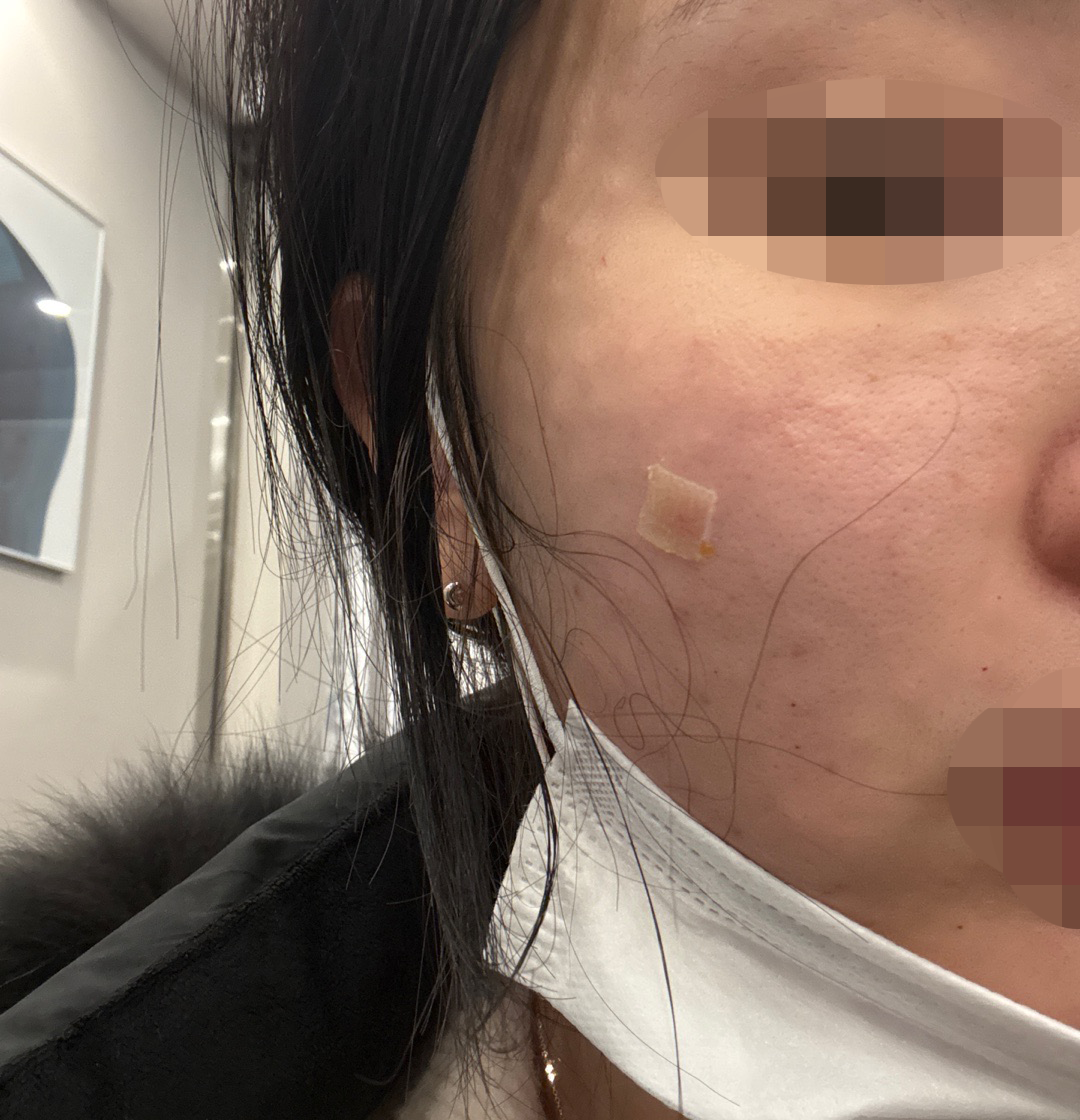 다른 병원이랑 차원이 다르게 꼼꼼해서 만족이에요 ㅎㅎ