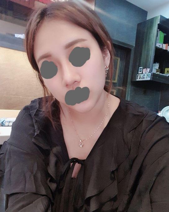복코 고민 싸악 해결????