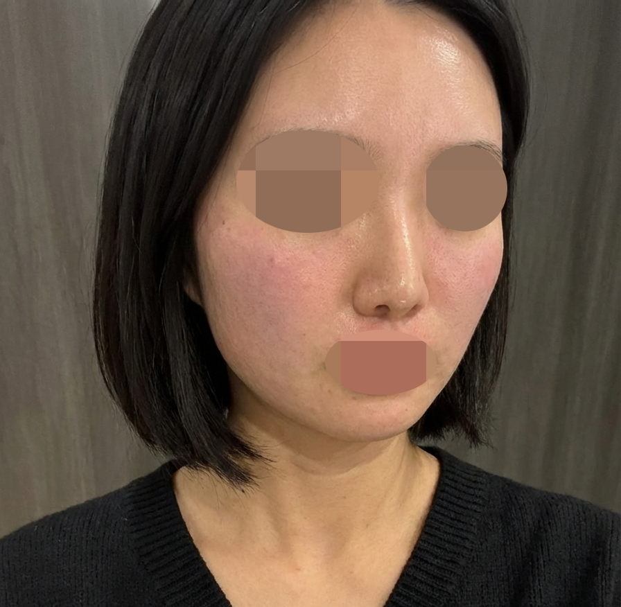 꼼꼼하게 잘 넣어주셔서 또 오고 싶어요! 재방문 의사 100%!!