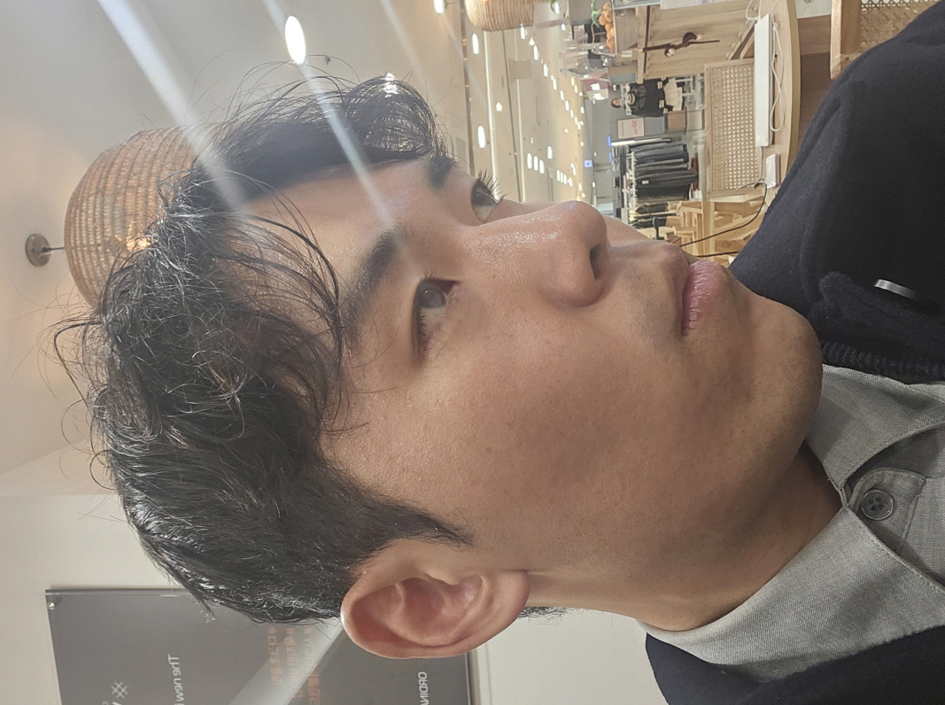 아직 붓기 빠지고 있는 중이지만 마음에 들어요