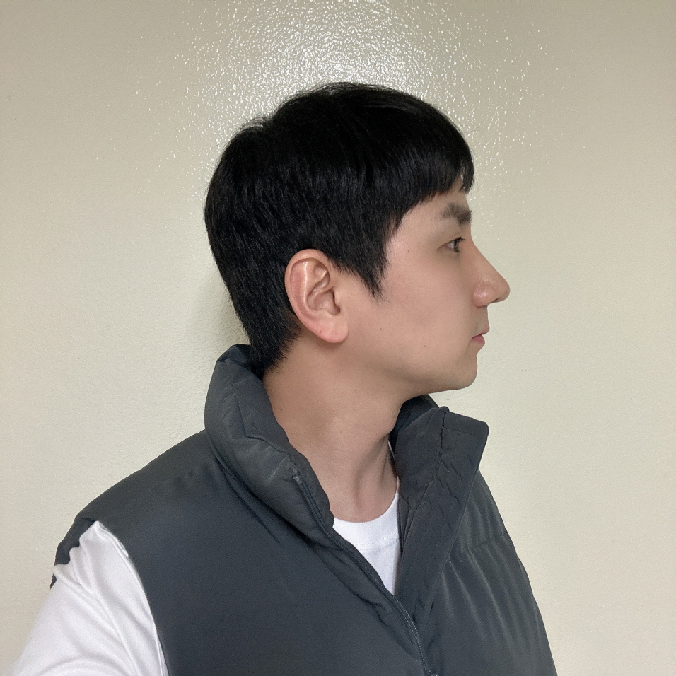 2주차인데 멍도 심하게안들고 콧대라인도 너무 자연스럽게 잘되어서 너무 만족합니다!