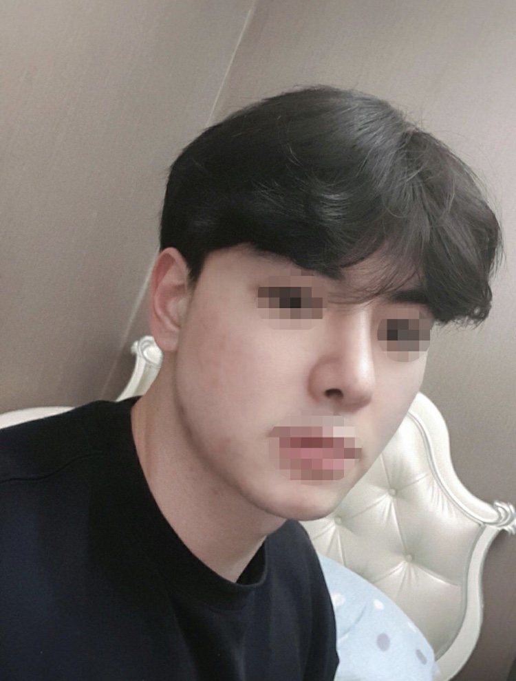 남자코 후기