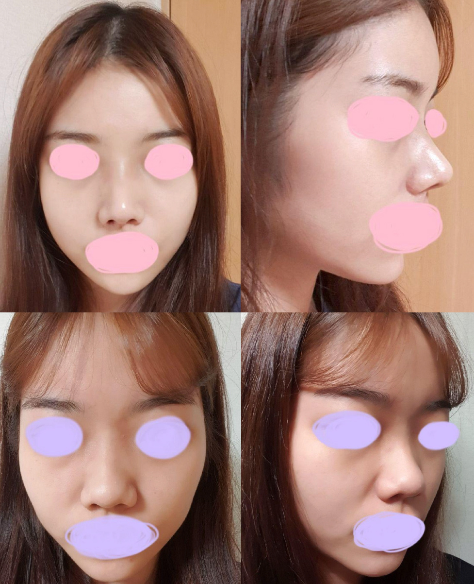 드뎌 2주찹니당1!!!!