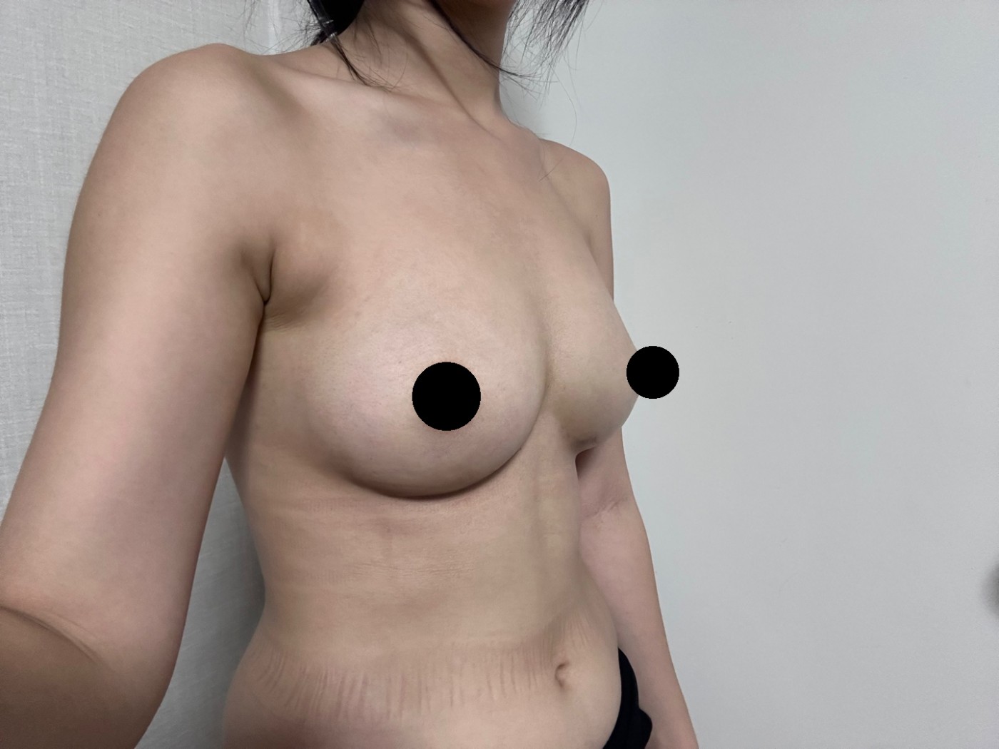 자기 지방으로 이정도 키울 수 있는게 너무 큰 장점인 거같아요