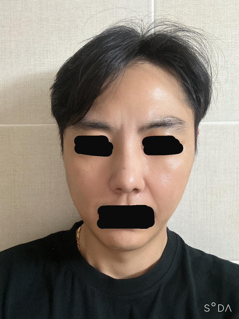 자연스러운 코가 좋은겁니다 ㅎㅎ 다들 성공하세요ㅎㅎ