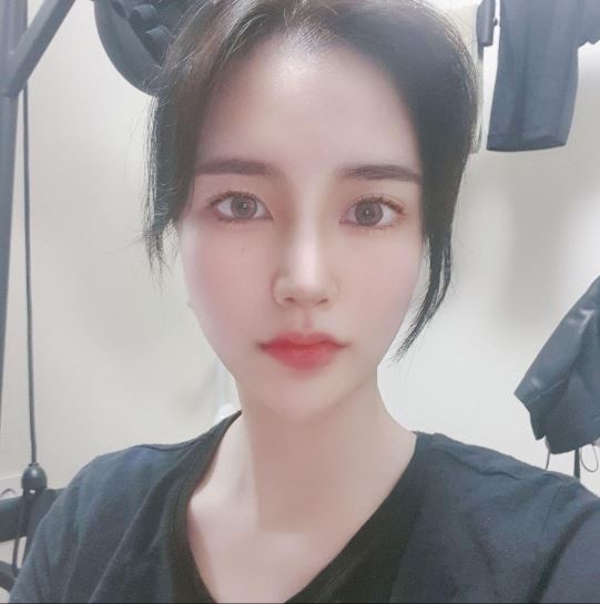 솔직담백 수술후기