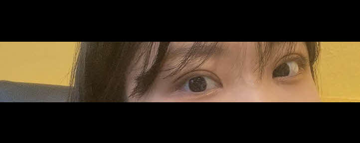 쌍수(매몰) 서울아이에서 했어영