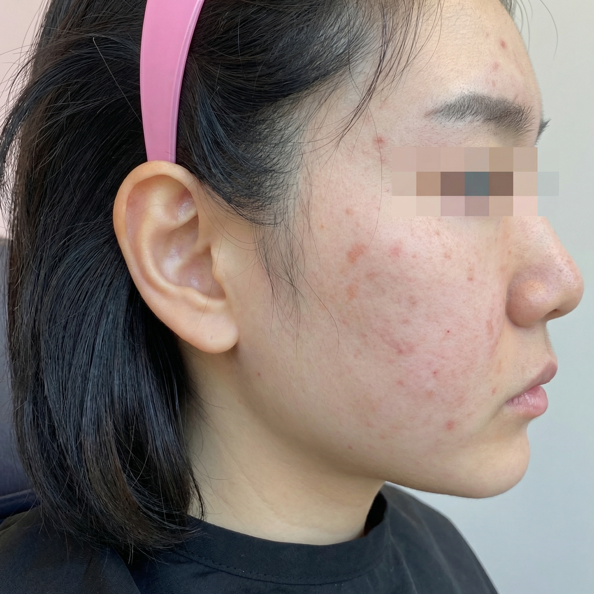 전체적으로 무너진 피부, 엘라비에 리투오로 관리 시작했어요